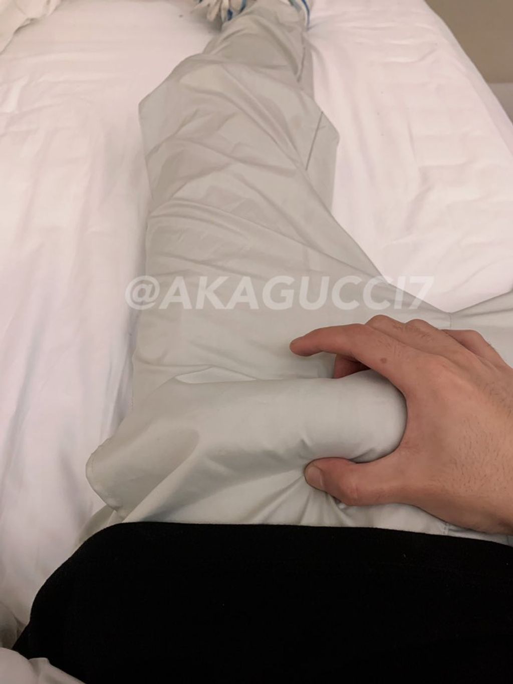 [OtherXXX] AKAGU： 长腿白虎福利姬 绝版私拍